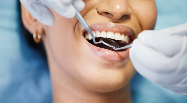 Best Emergency Root Canal Treatment in Gettysburg, SD