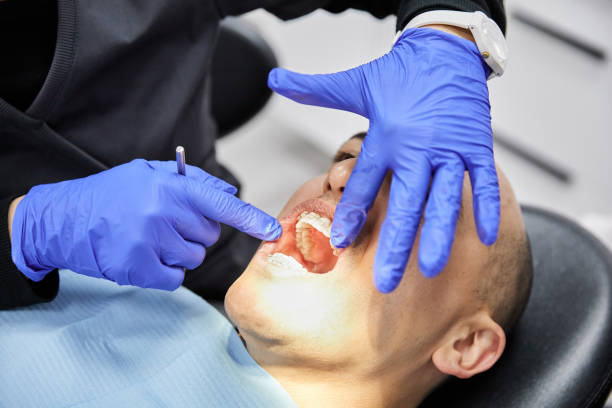 Best Emergency Dentist for Lost Fillings or Crowns in Gettysburg, SD